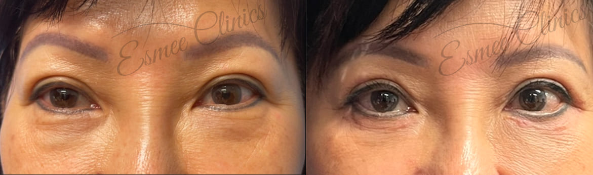 Before and After img